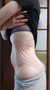 Kinesioloogia spordilint, elastne liim (2 foto / 2)