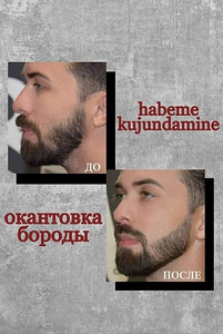 Удаление волос у мужчин (3 фото из 3)