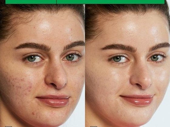 DR. JART+ Cicapair Tiger Grass Color Correcting Treatment