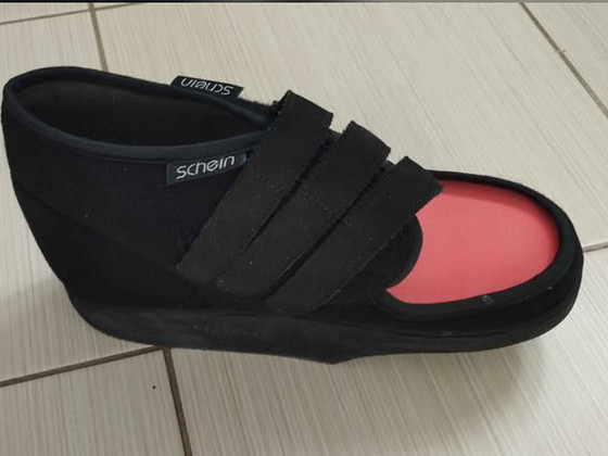 Schein Hallux Valgus