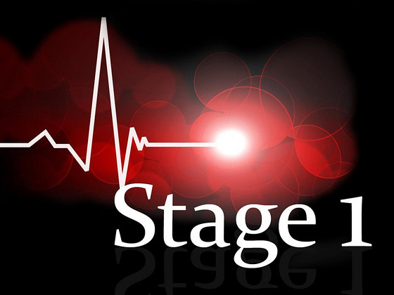 ЧИП-ТЮНИНГ STAGE 1
