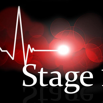 CHIP-TUNING STAGE 1